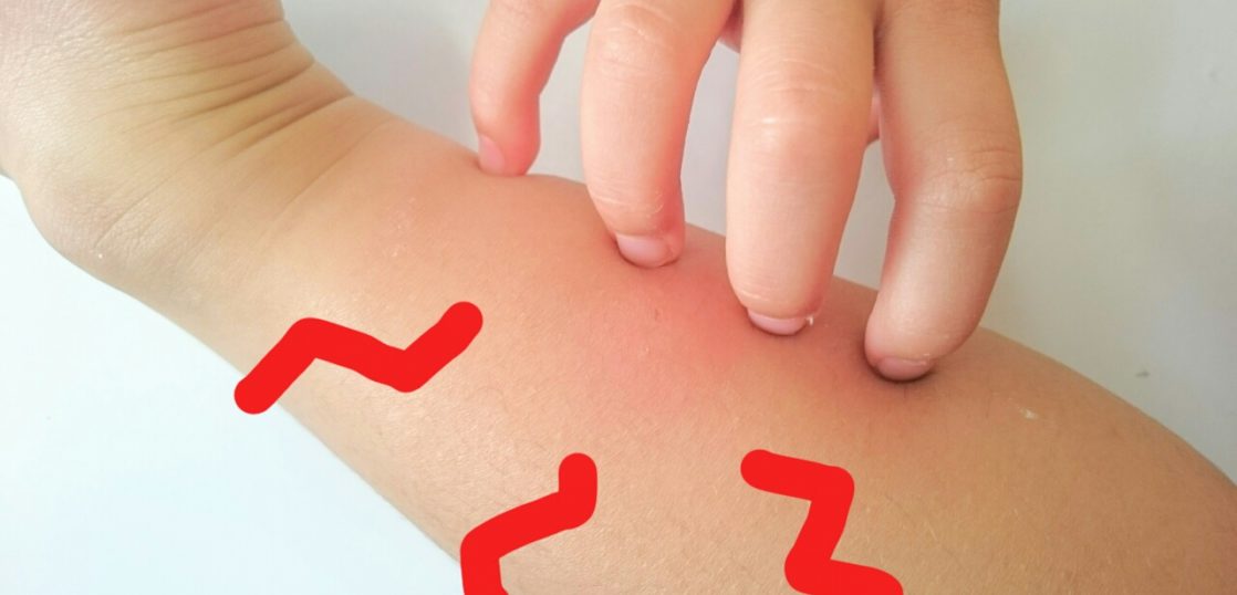 蚊に刺されない予防